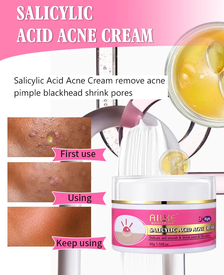 Organic Acne and Pimples Treatment Cream, Whitening Lotion,  Clarify, Cleaning, Moisturizing, Skin Glowing Skin Care