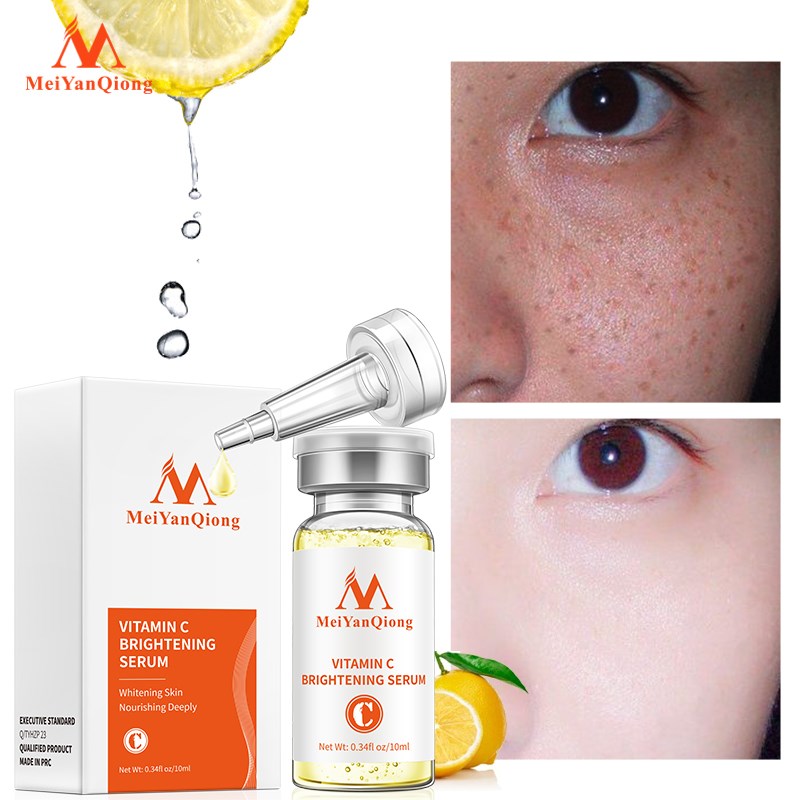 Vitamin Brightening Serum Moisturize Repair tender white Translucent Brighten skin Mild Hydrate Whitening skin care Essence 10ml