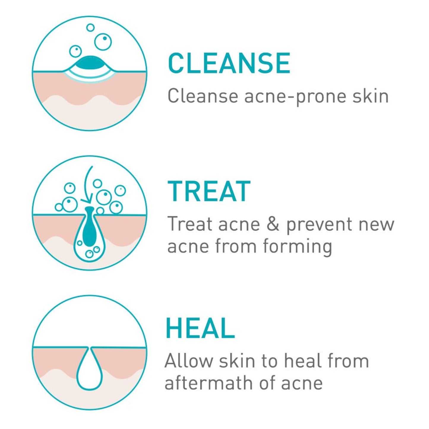 150ml CeraVe Acne Foaming Cream Cleanser Acne Treatment Face Wash Hyaluronic Acid Niacinamide Cream to Foam Formula