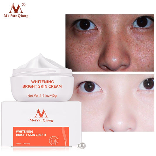 Moisturiser Face Whitening Freckle Cream Remove Acne Spots Melanin Dark Spots Face Lift Firming Face Skin Care Bright Skin Cream