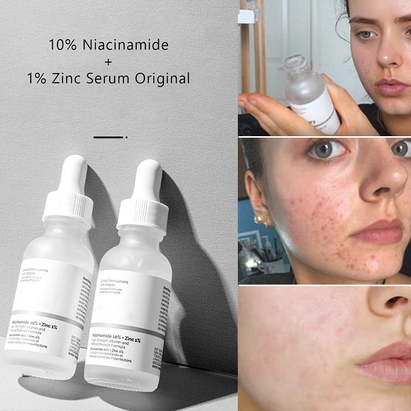 Original 30ml Niacinamide 10% + Zinc 1% Face Serum Skin Care Products Oil Whitening Moisturizer Essence Hydrating Balance